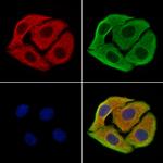 SAA2 Antibody in Immunocytochemistry (ICC/IF)