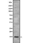 SAA4 Antibody in Western Blot (WB)