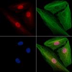 SF3B1 Antibody in Immunocytochemistry (ICC/IF)