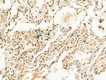 SF3B1 Antibody in Immunohistochemistry (Paraffin) (IHC (P))