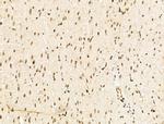 SF3B1 Antibody in Immunohistochemistry (Paraffin) (IHC (P))