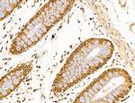 SF3B1 Antibody in Immunohistochemistry (Paraffin) (IHC (P))