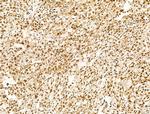 SF3B1 Antibody in Immunohistochemistry (Paraffin) (IHC (P))