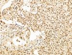 SF3B1 Antibody in Immunohistochemistry (Paraffin) (IHC (P))