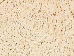 SF3B1 Antibody in Immunohistochemistry (Paraffin) (IHC (P))