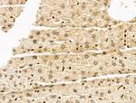 SF3B1 Antibody in Immunohistochemistry (Paraffin) (IHC (P))