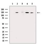 SF3B1 Antibody in Western Blot (WB)