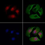 SATB2 Antibody in Immunocytochemistry (ICC/IF)