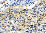 SATB2 Antibody in Immunohistochemistry (Paraffin) (IHC (P))