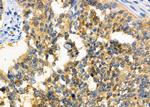 SATB2 Antibody in Immunohistochemistry (Paraffin) (IHC (P))