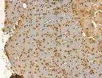 SRSF2 Antibody in Immunohistochemistry (Paraffin) (IHC (P))