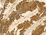 SRSF2 Antibody in Immunohistochemistry (Paraffin) (IHC (P))