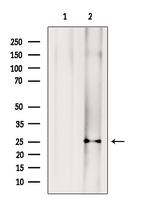 SRSF2 Antibody in Western Blot (WB)