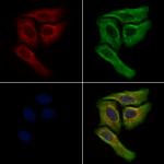 SCAP Antibody in Immunocytochemistry (ICC/IF)