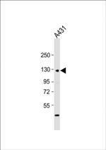 P-cadherin Antibody in Western Blot (WB)