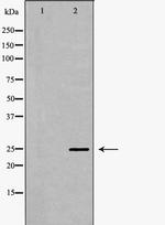 SCN4B Antibody in Western Blot (WB)