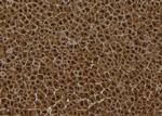 SESN2 Antibody in Immunohistochemistry (Paraffin) (IHC (P))