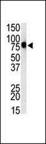 TLR1 Antibody in Western Blot (WB)