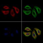 SHIP1 Antibody in Immunocytochemistry (ICC/IF)