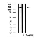 SHIP1 Antibody in Western Blot (WB)