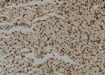 SHMT2 Antibody in Immunohistochemistry (Paraffin) (IHC (P))