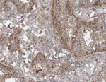 SIRT3 Antibody in Immunohistochemistry (Paraffin) (IHC (P))