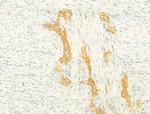 SIRT3 Antibody in Immunohistochemistry (Paraffin) (IHC (P))