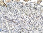 TAGLN Antibody in Immunohistochemistry (Paraffin) (IHC (P))