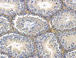 TAGLN Antibody in Immunohistochemistry (Paraffin) (IHC (P))