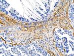 TAGLN Antibody in Immunohistochemistry (Paraffin) (IHC (P))