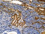 TAGLN Antibody in Immunohistochemistry (Paraffin) (IHC (P))