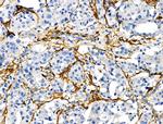 TAGLN Antibody in Immunohistochemistry (Paraffin) (IHC (P))