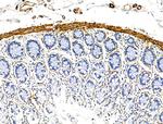 TAGLN Antibody in Immunohistochemistry (Paraffin) (IHC (P))