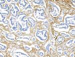 TAGLN Antibody in Immunohistochemistry (Paraffin) (IHC (P))