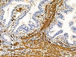 TAGLN Antibody in Immunohistochemistry (Paraffin) (IHC (P))