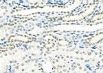 SMYD3 Antibody in Immunohistochemistry (Paraffin) (IHC (P))