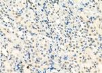 SMYD3 Antibody in Immunohistochemistry (Paraffin) (IHC (P))