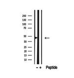 SMYD3 Antibody in Western Blot (WB)