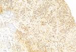 SNAIL Antibody in Immunohistochemistry (Paraffin) (IHC (P))