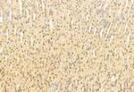 SNAIL Antibody in Immunohistochemistry (Paraffin) (IHC (P))