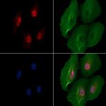 SNRNP70 Antibody in Immunocytochemistry (ICC/IF)