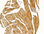 SNTB2 Antibody in Immunohistochemistry (Paraffin) (IHC (P))