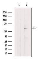 SNTB2 Antibody in Western Blot (WB)