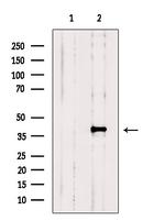 SNX6 Antibody in Western Blot (WB)