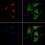 SOX11 Antibody in Immunocytochemistry (ICC/IF)