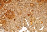 SP1 Antibody in Immunohistochemistry (Paraffin) (IHC (P))