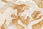 SP1 Antibody in Immunohistochemistry (Paraffin) (IHC (P))