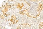 SP1 Antibody in Immunohistochemistry (Paraffin) (IHC (P))