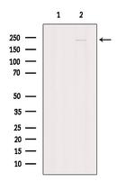 SPG11 Antibody in Western Blot (WB)