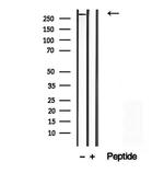 SPG11 Antibody in Western Blot (WB)